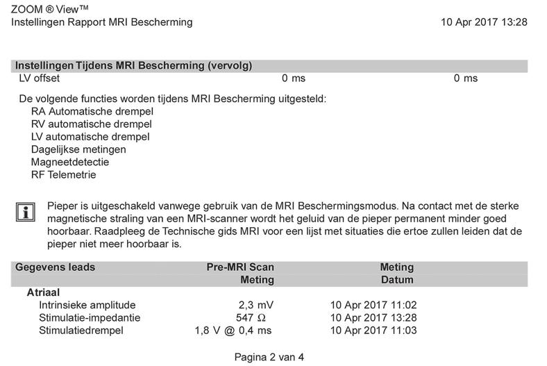 [2] De kolom met de meetdatum geeft de datum aan waarop de leadsgegevens werden verzameld, welke voor de