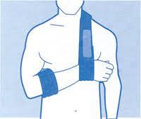 Figuur 3: juiste positie van arm in collar n cuff 7. Pijnmedicatie Op de afdeling zal de verpleegkundige regelmatig naar uw pijn vragen.