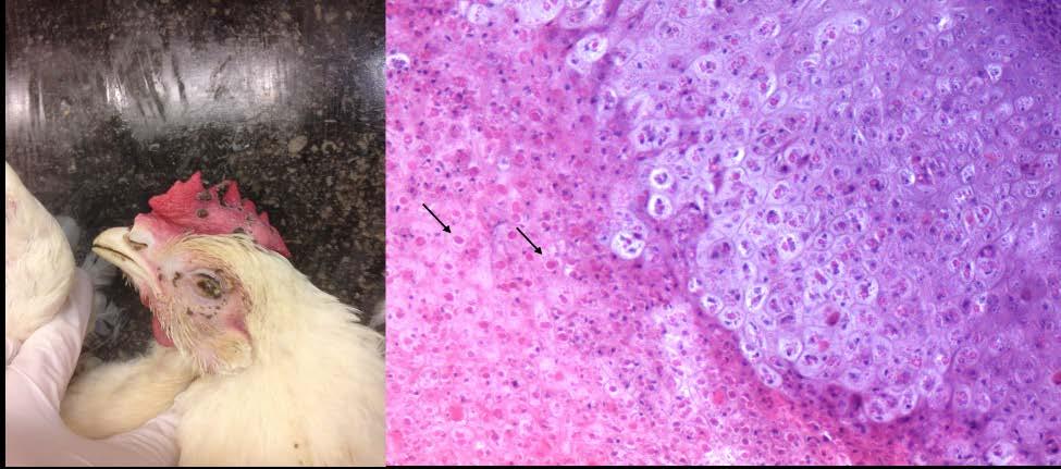 Foto 1: Macroscopsiche letsels van pokken. Foto 2: Histologisch beeld van pokkeninfectie van de huid met duidelijke aanwezigheid van veel intracytoplasmatiche eosinofiele inclusies (pijl).