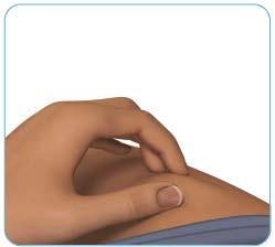 Stap 5: Knijp zachtjes in uw injectieplaats Knijp met uw duim en wijsvinger in de huid rondom de schoongemaakte