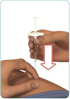 Figuur H Stap 6: Injecteer het geneesmiddel Houd de Zinbryta voorgevulde spuit boven de injectieplaats onder een hoek van