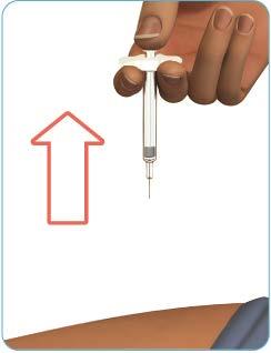 Stap 7: Verwijder de voorgevulde spuit uit de injectieplaats. Trek de naald in een rechte beweging terug (zie figuur K).