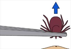 In alle gevallen moet de teek zo dicht mogelijk op de huid worden vastgepakt bij de kop van de teek, waarbij er niet in het achterlichaam van de teek mag worden geknepen.