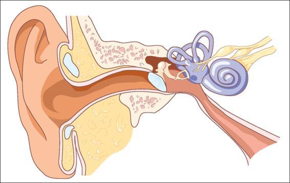 Eerste Hulp bij voorwerp in het oor Wat stel je vast? Pijn / kriebelingen in het oor. Soms gehoorproblemen, soms hikken.
