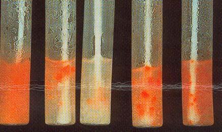 Microbiologie identificatie