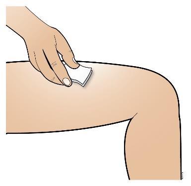 injectie toedient, kan ook de buitenkant van de bovenarmen worden gebruikt - Wissel de plaats bij elke injectie af. Niet injecteren op plaatsen met blauwe plekken of waar de huid gevoelig of hard is.