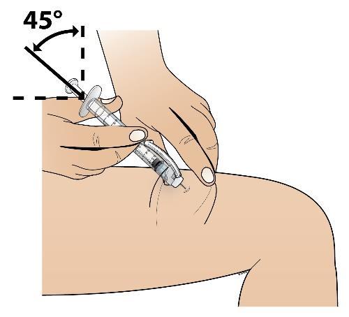 Houd met de andere hand de spuit (als een potlood) vast onder een hoek van 45 graden ten opzichte van de huid. Duw met een korte, scherpe beweging de naald in de huid.