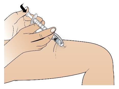 Wanneer de spuit leeg is, de naald uit de huid trekken onder dezelfde hoek als bij het inbrengen. De injectieplaats kan iets bloeden.