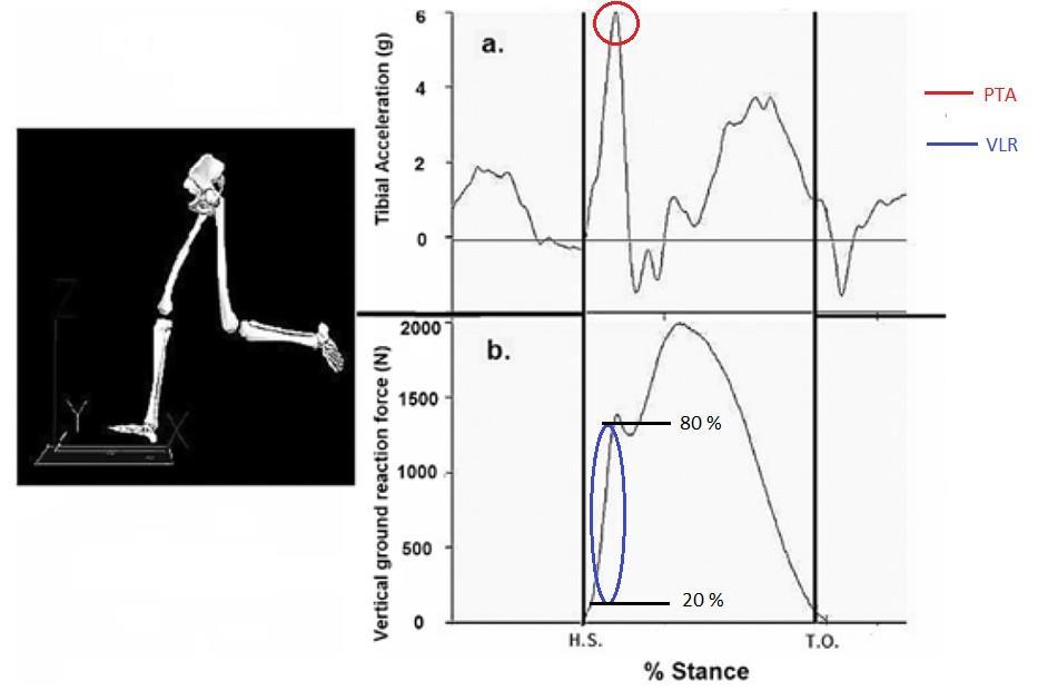 (B) De impactschok is een tijdelijke toestand waarin het evenwicht van een systeem wordt verstoord door een plotse acceleratie (Nigg et al., 1995).