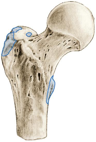 Heupgewrichtsspieren 3 7.Ba Heupspieren (heupgewrichtsspieren), aanhechting op het femur, vooraanzicht. 0 M. piriformis binnenzijde van de punt van de trochanter major 0 M.