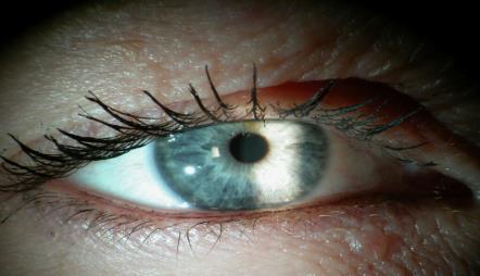 Wat is staar Vóór in het oog, vlak achter de pupil, zit de heldere en doorzichtige ooglens. Naarmate we ouder worden, wordt deze lens minder helder.