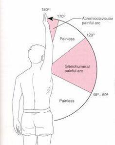 Impingement testen