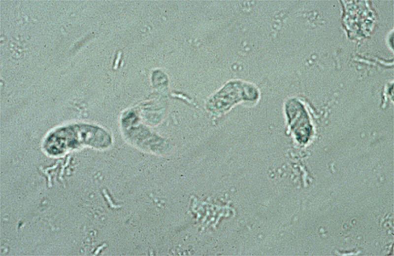 Myxamoeben onder een microscoop 4. Voedselopname De amoeben voeden zich met bacteriën en schimmels. Als ze groot genoeg zijn begint de celdeling. 5.