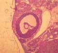 Alle andere atrofiëren. Bij het begin van de rijping wordt de primaire eicel groter. Ondertussen delen de follikelcellen zich en groeperen ze zich in vele rijen rondom de eicel.