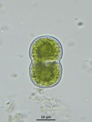 plasje (fig. 1) opvallend groen gekleurd was door algen. Ik heb toen een beetje van die modder in een monsterpotje gedaan. bolvormig waren.