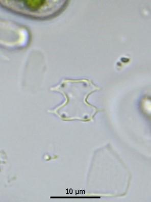Meer waarnemingen van zygosporen en de daarbij horende levende cellen zijn nodig om duidelijkheid te