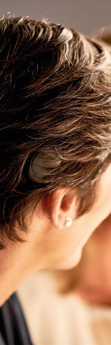 Gebruikers van cochleaire implantaten die Kanso al hebben uitgeprobeerd, vinden het fantastisch hoe deze off-the-ear geluidsprocessor het