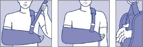 kunt u zien hoe u de sling aanbrengt. Let op dat de draagband over de gezonde schouder loopt. Ook zijn er een aantal oefeningen die u elke dag moet uitvoeren (figuur 2 en 3).