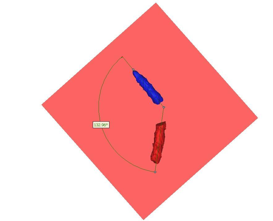 Hiervoor werd een cylinder geconstrueerd met de diameter van de midsectie van de voorste, respectievelijk achterste kruisband doorheen het centrale punt van de insertie