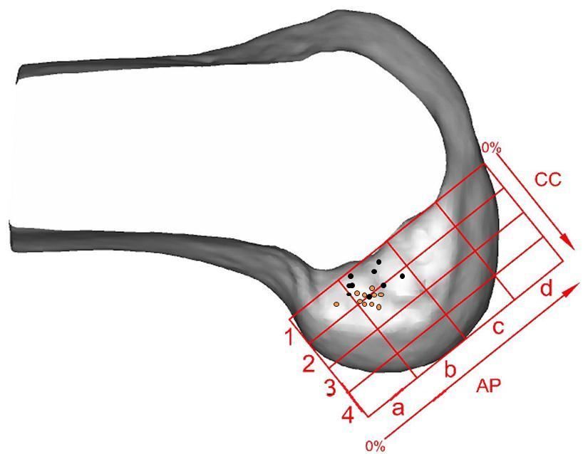 Transtibiaal Anteromediaal CC (%) PA (%) CC (%) PA (%) Knie 1 2.3 30.7 28.6 34.6 Knie 2 8.4 42.2 36.6 30.4 Knie 3 9.3 27.7 31.1 29.9 Knie 4 25.9 37.9 16.5 27.5 Knie 5 14.0 25.5 26.7 32.7 Knie 6 9.