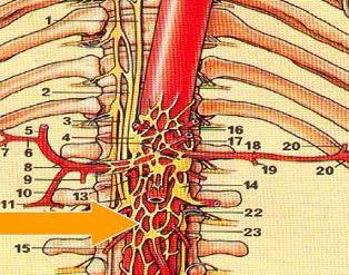 Radiofrequente of chemische behandeling