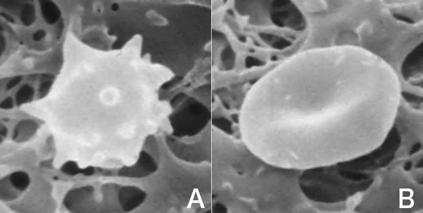 BLOOD STORAGE ATP