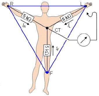 (ECG) legde met introductie van driehoek van Einthoven in 1912 basis vd moderne ECG afleiding I = bipolaire afleiding tss RA en LA afleiding II = bipolaire afleiding tss RA en LV afleiding III =