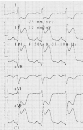 V 4; evt in I o