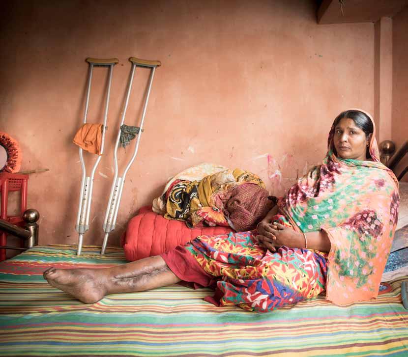 Nilufa Begum (35) overleefde de Rana Plaza-ramp, maar hoe : Elke dag heb ik medicatie nodig. Ik kan niet slapen van de pijn. Soms denk ik dat ik mijn eigen been zou willen afzetten. Amputeren?