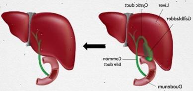 Bilirubine is een afvalproduct van oude rode bloedcellen die worden afgebroken in de milt en lever. Cholesterol is een vetachtige stof die een belangrijke bouwsteen is voor de cellen in het lichaam.