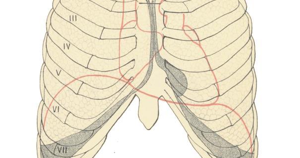 thymoma, intrathorakale schildklier goiters Pleura: -