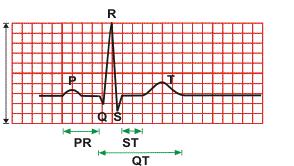 De pieken en dalen op een hartfilmpje worden aangeduid met de hoofdletters P, Q, R, S en T. De weergave van de elektrische prikkel die de hartkamers laat samentrekken is het QRScomplex.