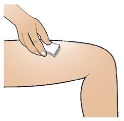 iemand anders bij u de injectie toedient, kan ook de buitenkant van de bovenarmen worden gebruikt Injectieplaats - Wissel de plaats bij elke injectie af.