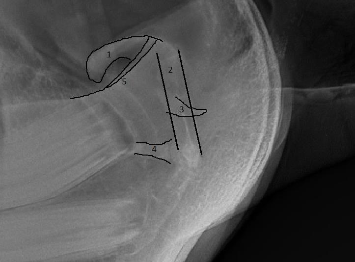 Ook de diameter van de nasofarynx is verkleind (Kliniek medische beeldvorming van de grote huisdieren. Ugent). Afbeelding 3: Radiografie van de Larynx.