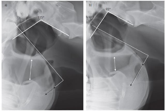 Figuur 16 (naar Fjordbakk et al. 2013): Laterale radiografische opnames van de larynx regio van paarden met DLC geassocieerd met nek flexie.