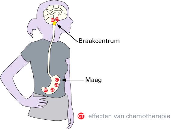 Misselijkheid en braken Als reactie op de behandeling kan u misselijk zijn of moeten braken. Veel mensen hebben schrik voor deze bijwerking.