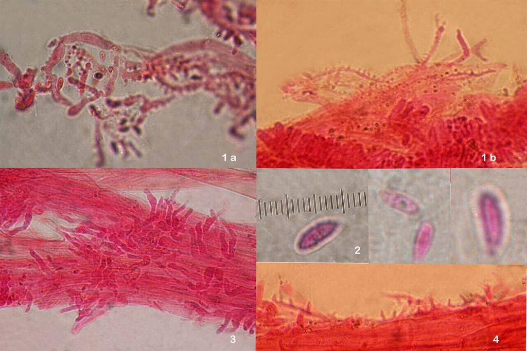 8 Fig 7: Microscopie 1a-1b. pileipellis 2. sporen 3-4.