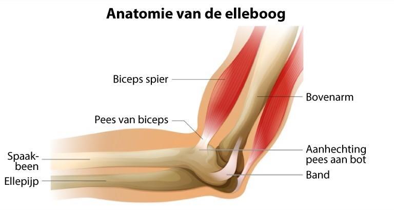 Als het slijmvlies aan de achterzijde van de elleboog ingeklemd zit. Dit heet een posterieur impingement. Als een versleten elleboog (artrose) schoongemaakt kan worden.