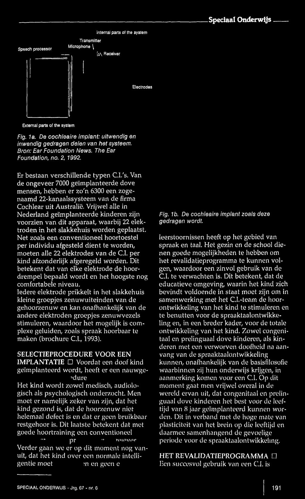 Speciaal Onderwtfs Internal parts of the system Speech processor Transmitter Microphone \ [o\ Receiver Electrodes External parta of the system Fig. 1a.