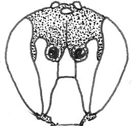 Witte gezichtstekening reikt niet tot de voelsprietbasis. 4,5-5,5 mm....hylaeus gracilicornis 13.2: H. gracilicornis 14.2.1: eerste voelsprietlid lang 14.