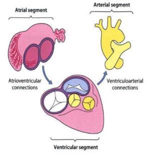 ventriculo-arteriele connecties (DORV, TGA)