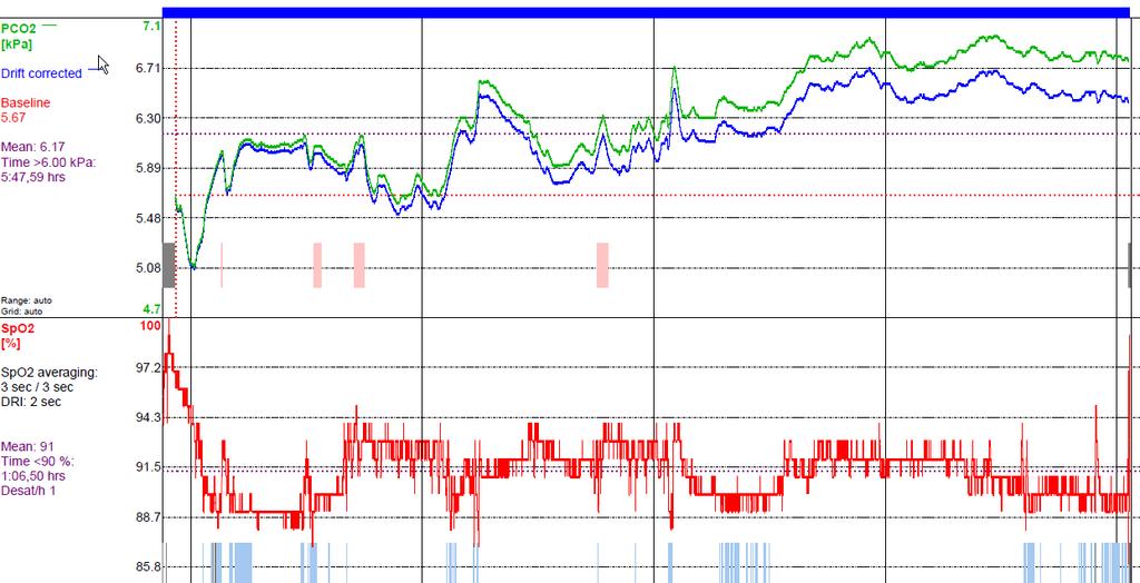 Nocturnal assessment with NIV BiPAP