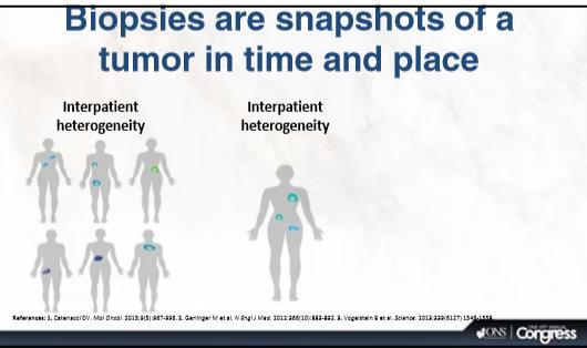 Precision medicine has the potential to benefit patients Bedenk wel dat biopties snapshots zijn van een tumor in tijd en plaats Bij een metastase