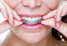 inclusief niet Onzichtbaar de tanden recht? Dat kan met Excent AirSmile! Regelmatig zijn mensen ontevreden over de stand van hun tanden.
