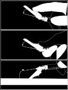 Verwijder daarna de beschermhuls van de naald. Houd de spuit rechtop met de naald naar boven gericht en duw zachtjes tegen de plunjer totdat het medicijn in het puntje van de spuit zit.