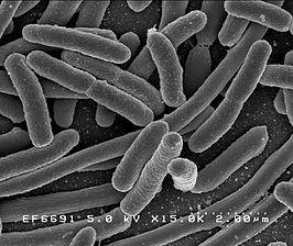 Wat is dat voor iets, die E.coli?