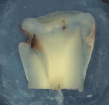 Evidence-based tandheelkunde Figuur 1 Voorbeeld van een histologische coupe als gouden standaard. Figuur 2 Voorbeeld van een micro-ct-doorsnede als gouden standaard.