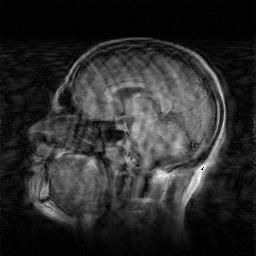 Figuur 5.2: Een sagittale doorsnede van de hersenen.