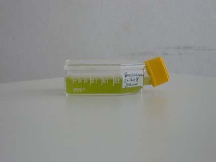 experiment in 30 ml (boven van links naar rechts en van boven naar