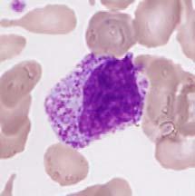 Wat betreft de elliptocytose Hoewel erfelijke elliptocytose vaker voorkomt bij Afrikanen, is er geen verband aangetoond met een bepaald ras.